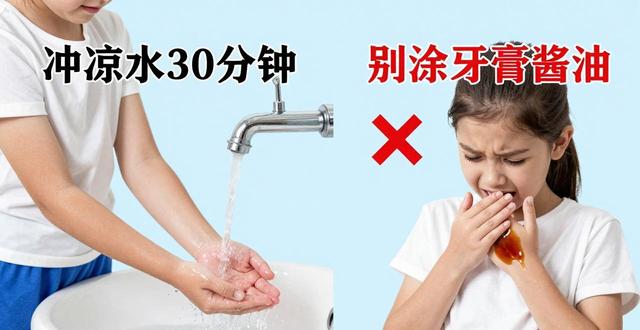 小孩烫伤手图片大全_小孩儿手烫伤时怎么处理_小孩烫伤手要忌口什么